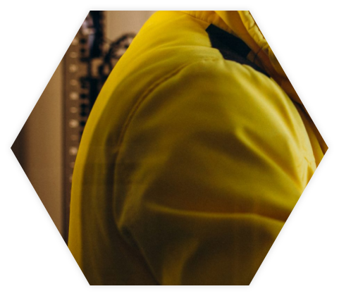 Ansicht eines Schulter mit Gelben Oberteil